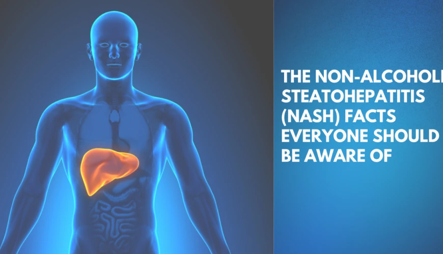 The Non-Alcoholic Steatohepatitis (NASH) Facts Everyone Should Be Aware Of