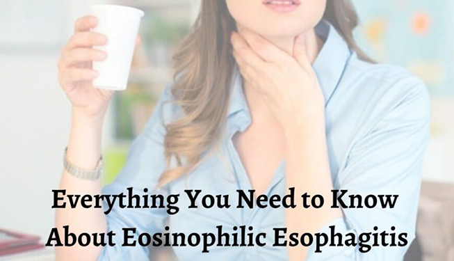 Everything You Need to Know About Eosinophilic Esophagitis